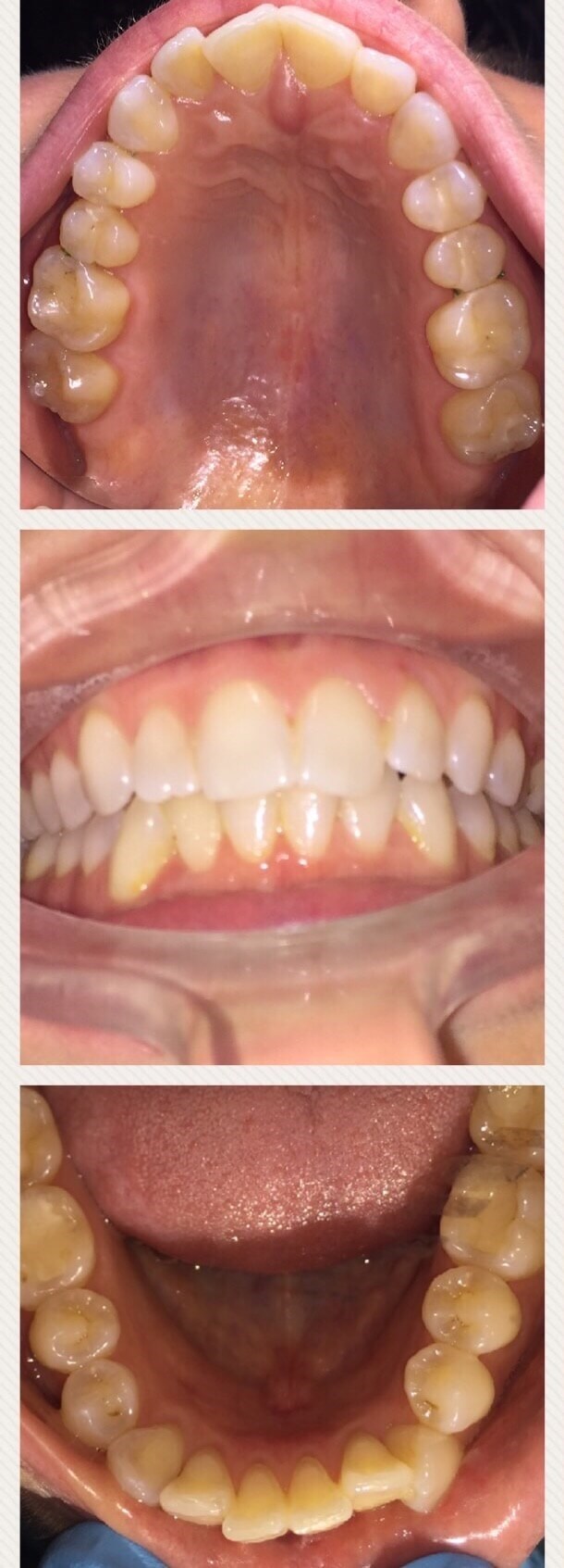 Before Image