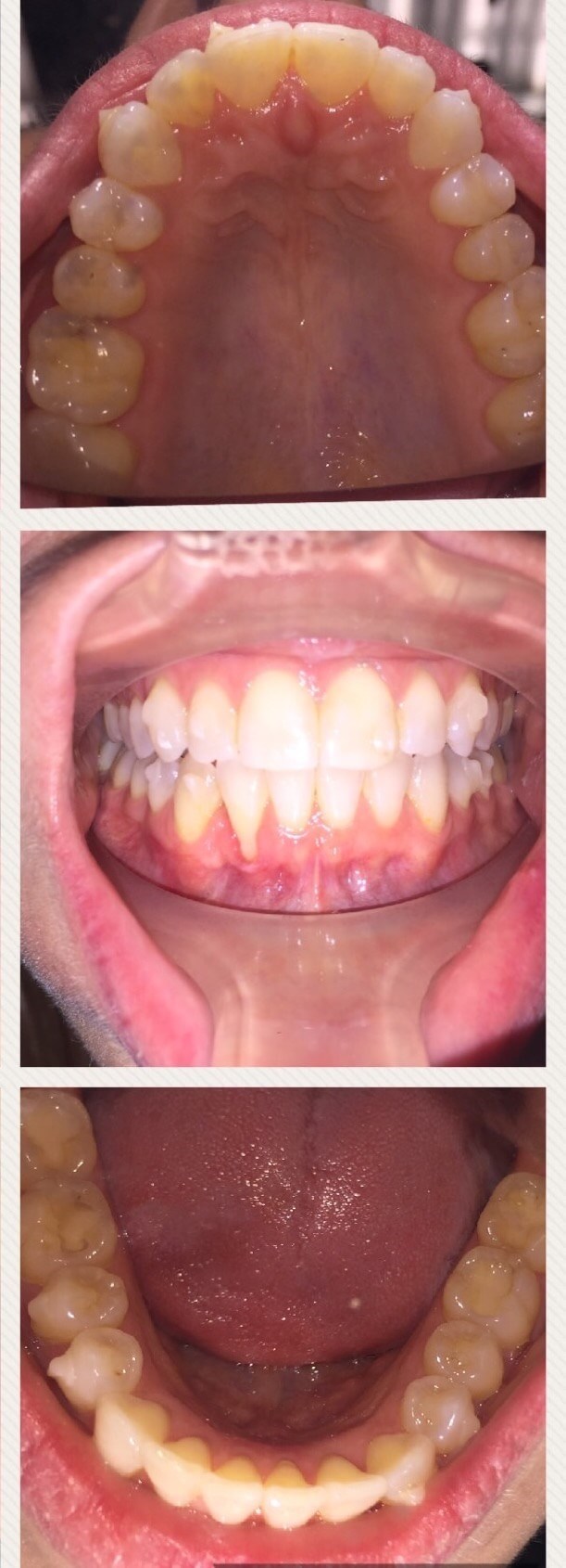 After Image
