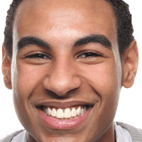 Teeth Whitening