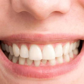 Periodontal Examination