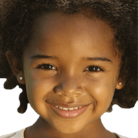 Fluoride Treatment