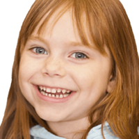 Dental Sealants